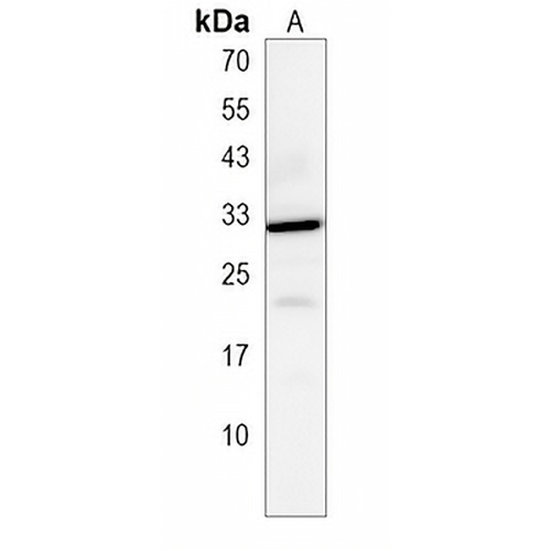 TCEAL2 Rabbit Polyclonal Antibody