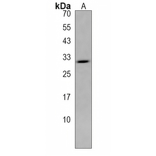 TTYH1 Rabbit Polyclonal Antibody