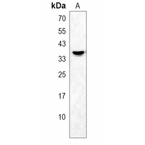 OR2AG2 Rabbit Polyclonal Antibody