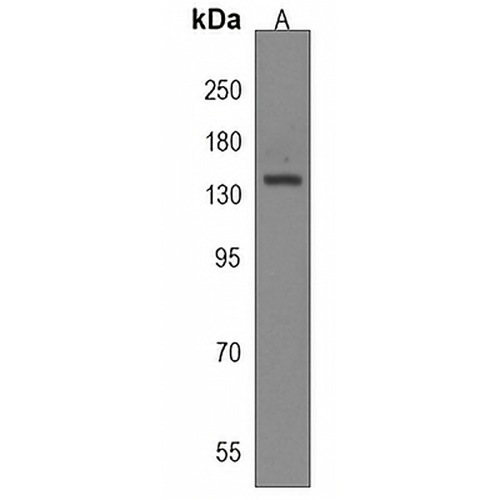 CAMSAP3 Rabbit Polyclonal Antibody