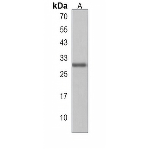 THAP10 Rabbit Polyclonal Antibody