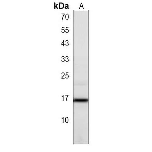 C2orf83 Rabbit Polyclonal Antibody