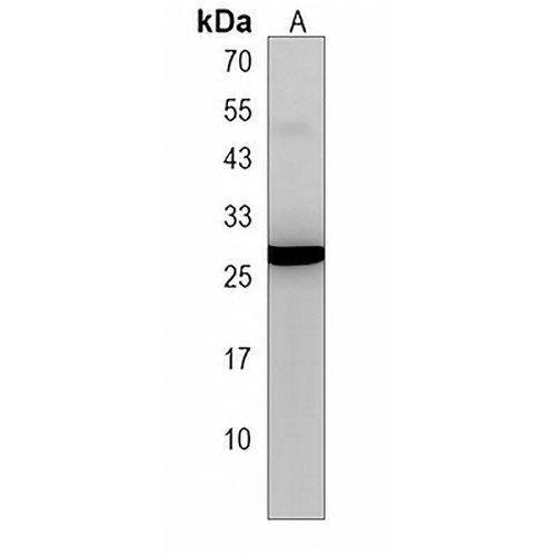SIRPD Rabbit Polyclonal Antibody