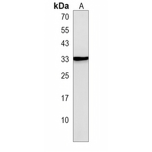 SSX3 Rabbit Polyclonal Antibody