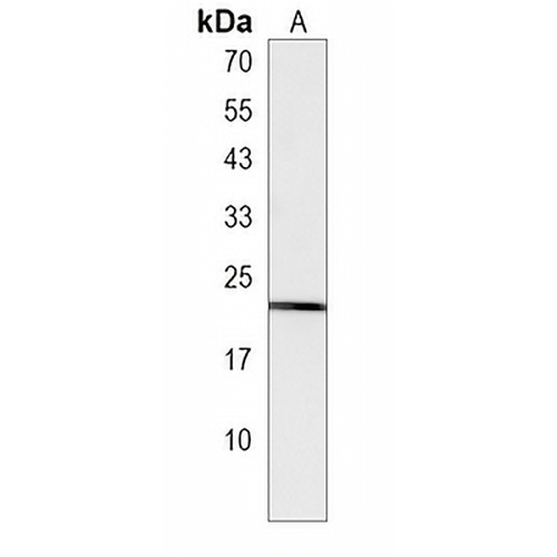 TAGLN3 Rabbit Polyclonal Antibody