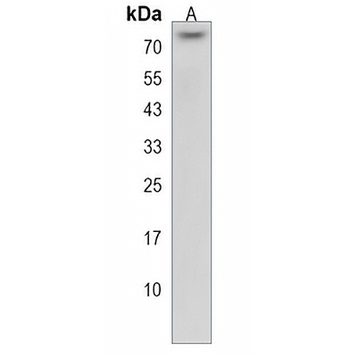 ZNF416 Rabbit Polyclonal Antibody