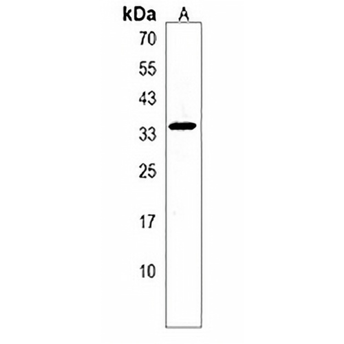 FAHD2B Rabbit Polyclonal Antibody