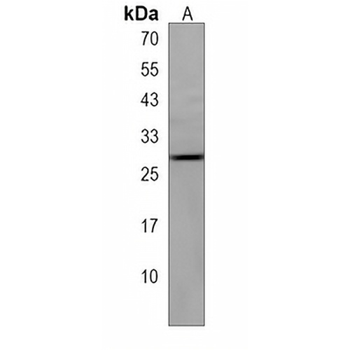 IGLL5 Rabbit Polyclonal Antibody