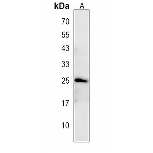 BTG4 Rabbit Polyclonal Antibody