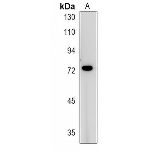 KIZ Rabbit Polyclonal Antibody
