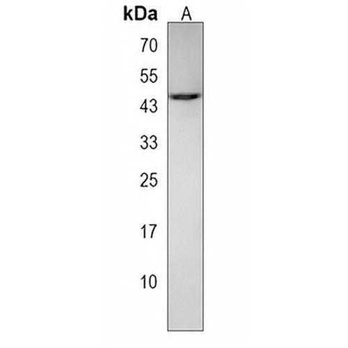 MPPE1 Rabbit Polyclonal Antibody