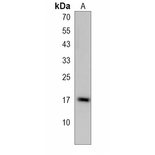 RAB19 Rabbit Polyclonal Antibody