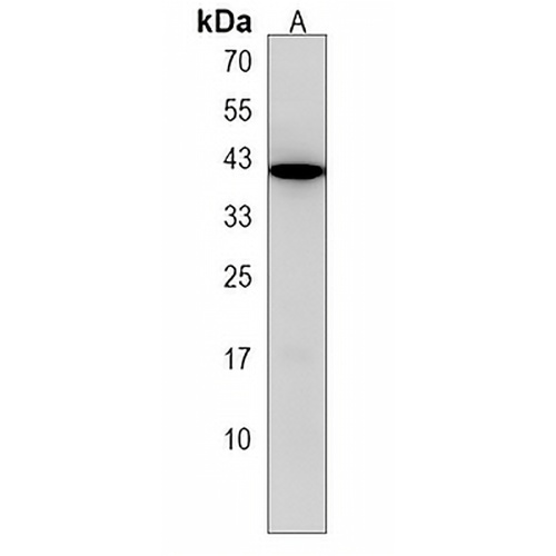 GDE1 Rabbit Polyclonal Antibody