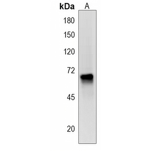 PKD2L2 Rabbit Polyclonal Antibody