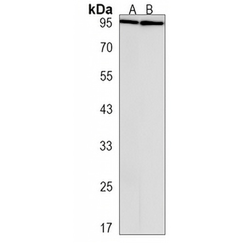 TCHHL1 Rabbit Polyclonal Antibody