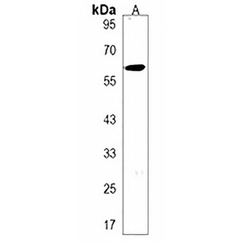 TRPC4AP Rabbit Polyclonal Antibody