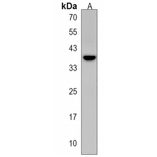 ARMCX4 Rabbit Polyclonal Antibody