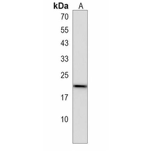 PMS2P5 Rabbit Polyclonal Antibody