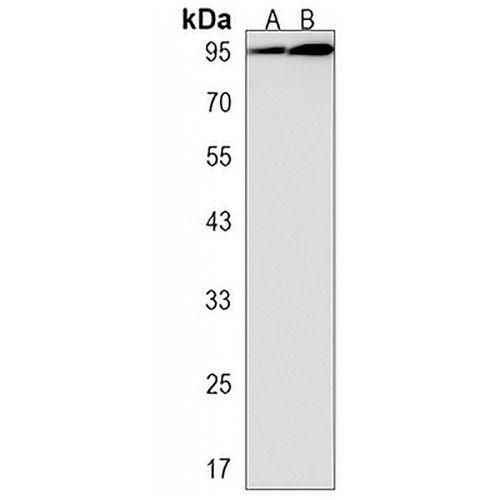 MBD6 Rabbit Polyclonal Antibody