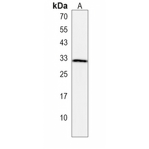 OR10T2 Rabbit Polyclonal Antibody