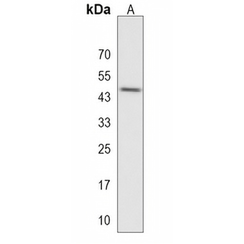 RUNDC3A Rabbit Polyclonal Antibody