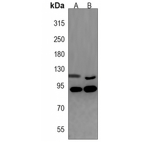 SLCO1B3 Rabbit Polyclonal Antibody