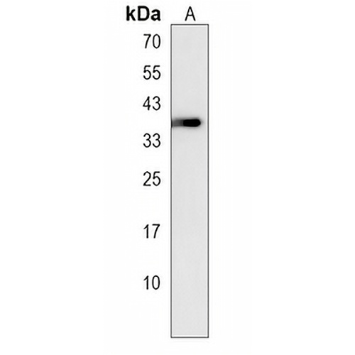 KCTD17 Rabbit Polyclonal Antibody