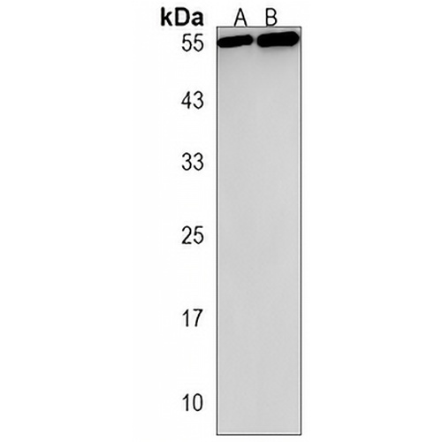 TBX4 Rabbit Polyclonal Antibody