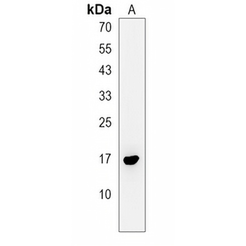 PAPPA-AS1 Rabbit Polyclonal Antibody