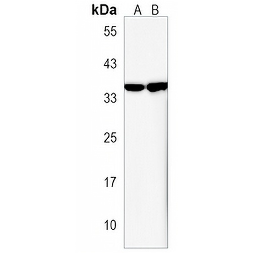 OR5AK2 Rabbit Polyclonal Antibody