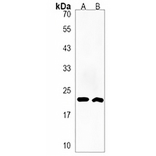 HSPB9 Rabbit Polyclonal Antibody