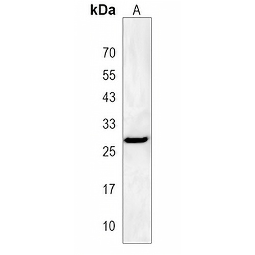 HILS1 Rabbit Polyclonal Antibody