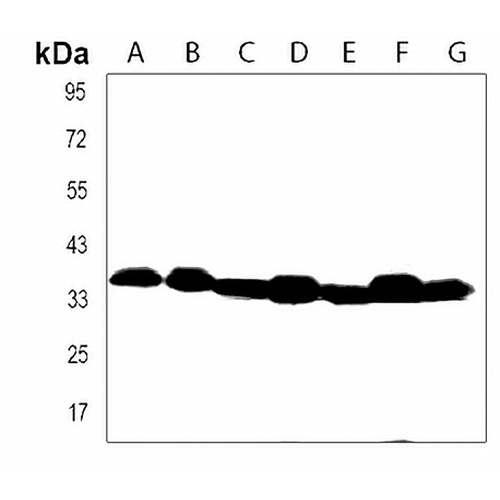 GATSL2 Rabbit Polyclonal Antibody