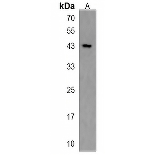 ZNF73 Rabbit Polyclonal Antibody