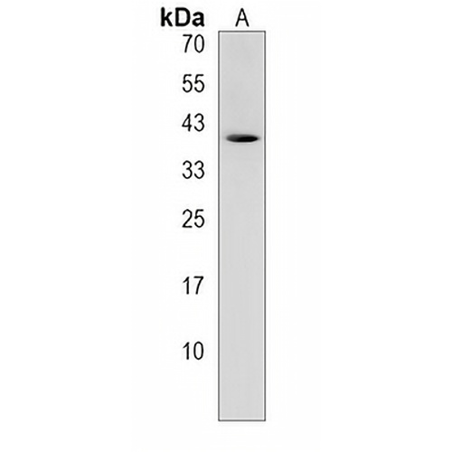 CTRB1 Rabbit Polyclonal Antibody