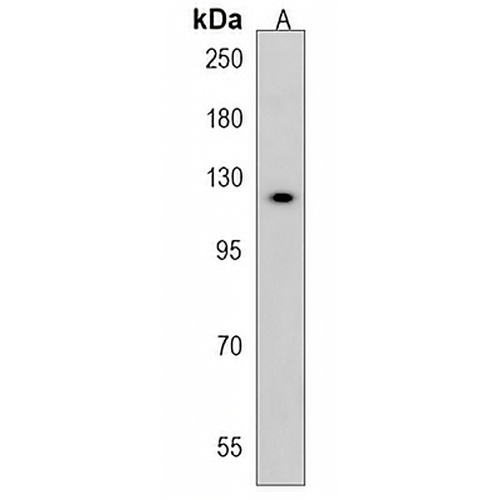 WDR64 Rabbit Polyclonal Antibody