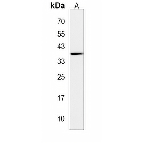 RRN3P2 Rabbit Polyclonal Antibody
