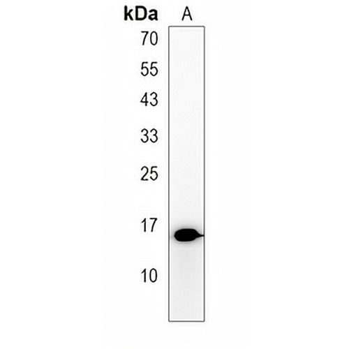 HIGD1C Rabbit Polyclonal Antibody