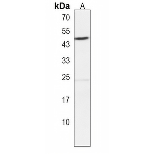 Septin 12 Rabbit Polyclonal Antibody