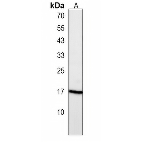 RPL13A Rabbit Polyclonal Antibody