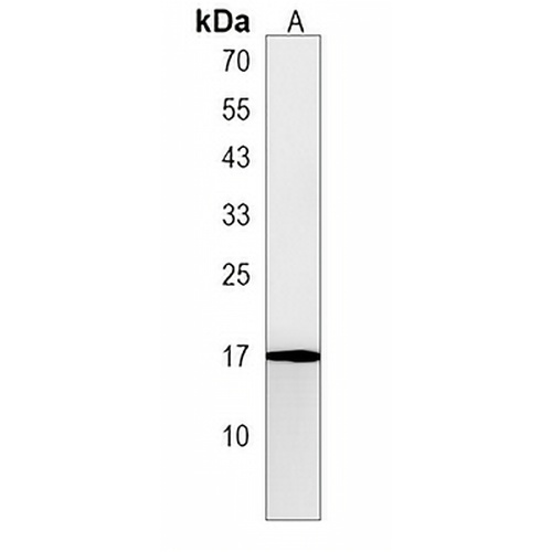 PLAC1 Rabbit Polyclonal Antibody