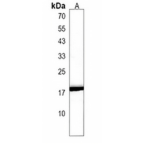 ANKRD37 Rabbit Polyclonal Antibody