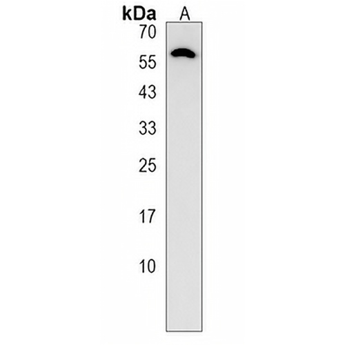 ST6GAL2 Rabbit Polyclonal Antibody