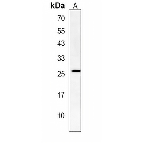 TFEC Rabbit Polyclonal Antibody