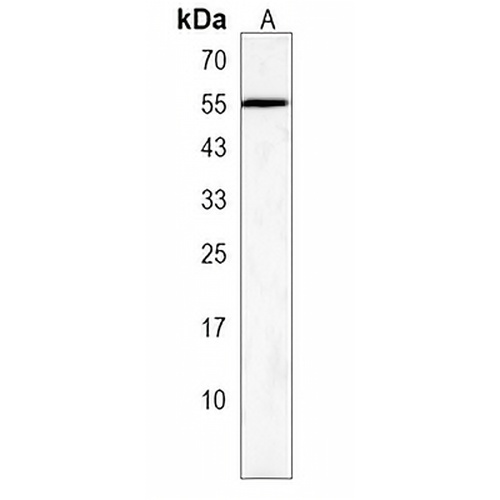 ZNF101 Rabbit Polyclonal Antibody
