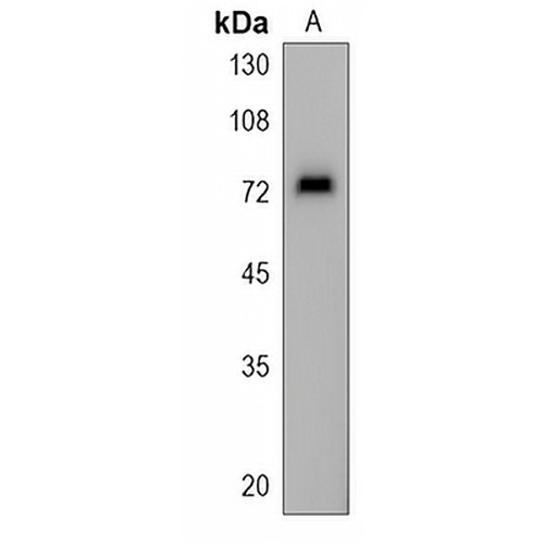 ASNSD1 Rabbit Polyclonal Antibody