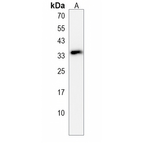 RAET1E Rabbit Polyclonal Antibody
