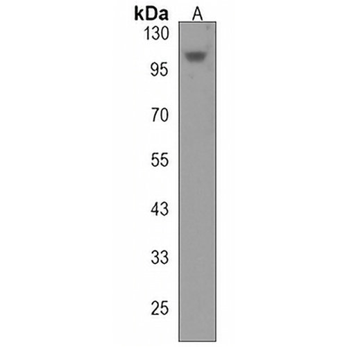 Kv2.2 Rabbit Polyclonal Antibody