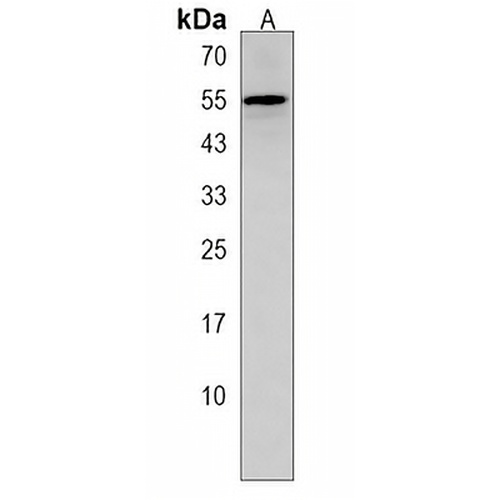 ZSCAN5C Rabbit Polyclonal Antibody