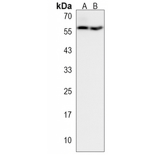 TMX3 Rabbit Polyclonal Antibody